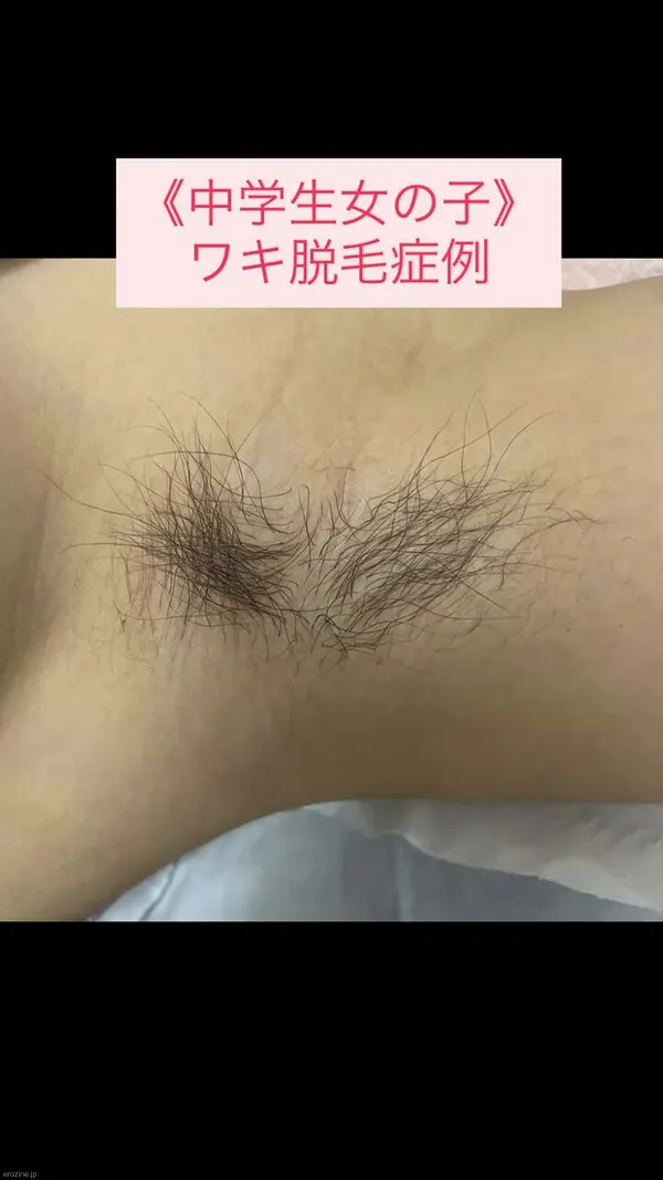 Xエロ動画 00:08